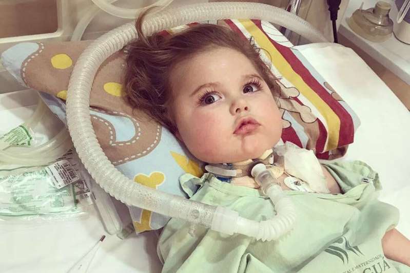 Foto:  bebê Jonatas, no primeiro dia de tratamento com medicamento importado